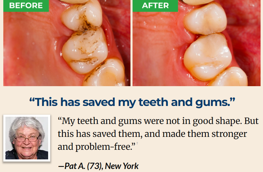 ProXental Customer Reviews